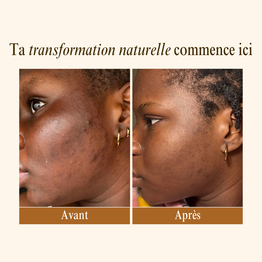 Rituel Anti-Imperfections