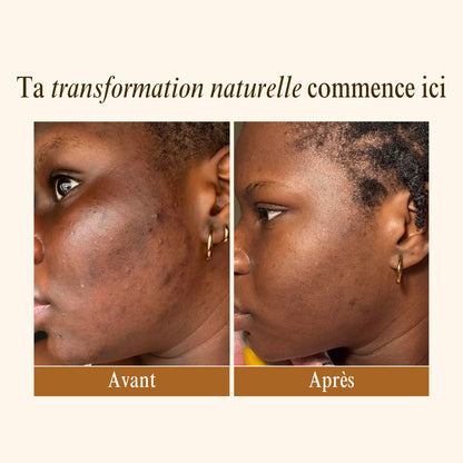 Rituel Anti-Imperfections